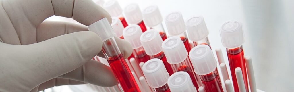 Чим небезпечний низький гемоглобін: пояснює лікар